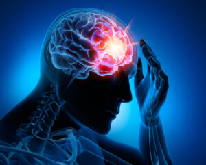 Why Hire Omar Khawaja Personal Injury Lawyers If You’ve Suffered a Brain Injury in Houston, TX?